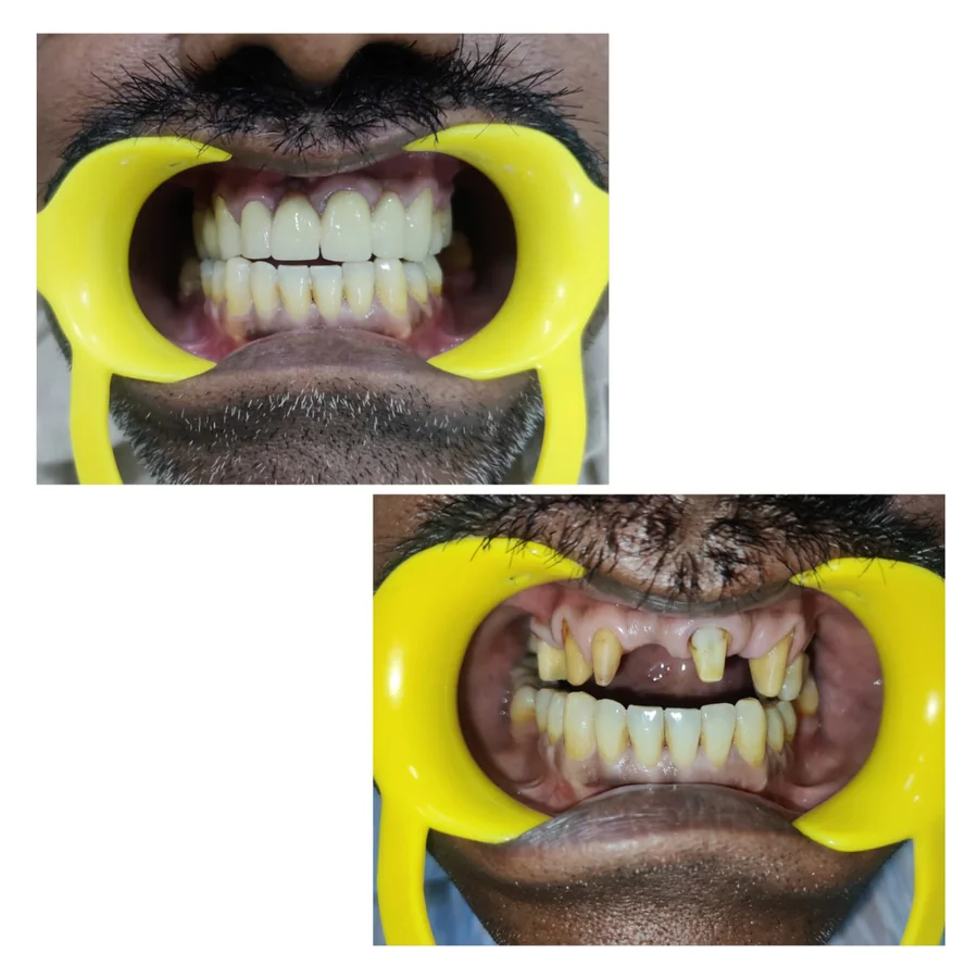 Shanthi Dental Care - Comprehensive Smile Transformation