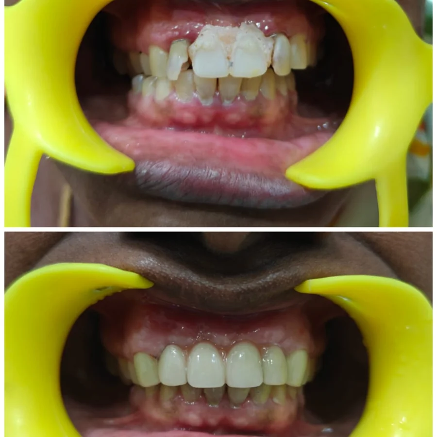 Shanthi Dental Care - Precision Orthodontic Alignment